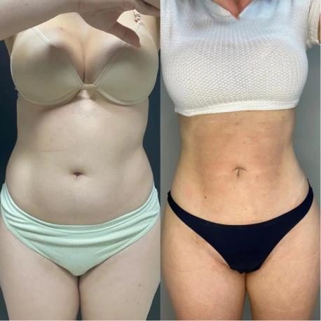 0a12f35a-effb-4819-9a61-1c6ab1c68ce4