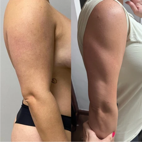 49bb1099-1e24-48f2-a557-535b82f832d3