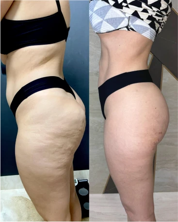 bd4302c4-79f6-4326-b616-60e2dff86e3e